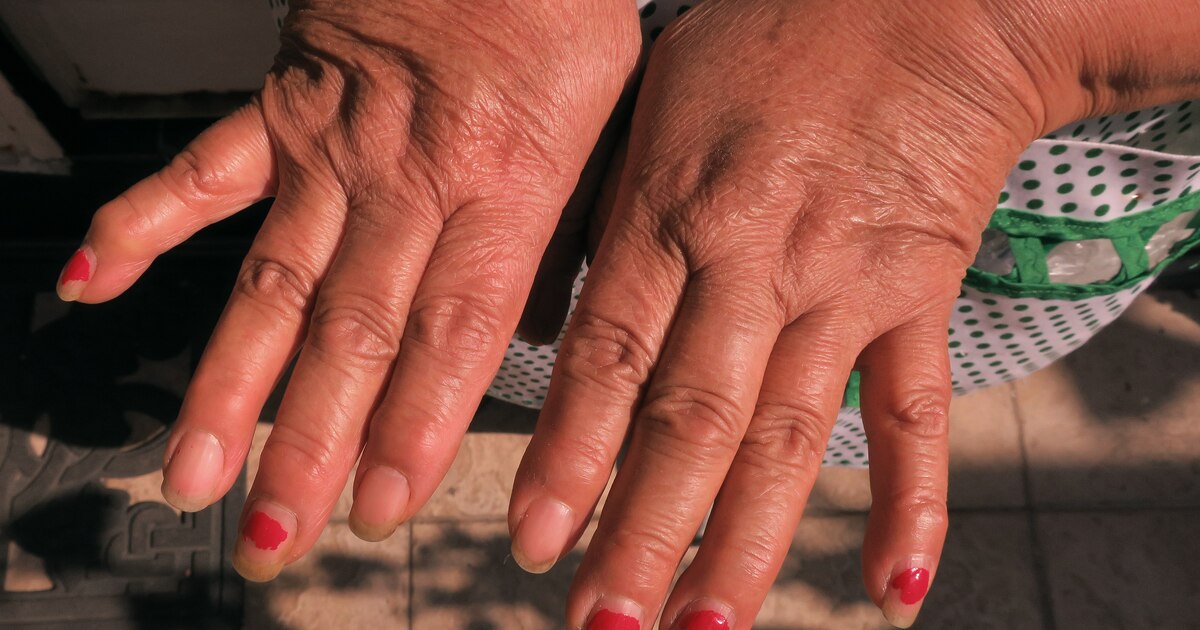 Imagen de archivo de la Copa Mundial FIFA 2026. La nota de Infobae reproduce el comunicado EFE sobre osteoartritis y el frío. Foto: EFE